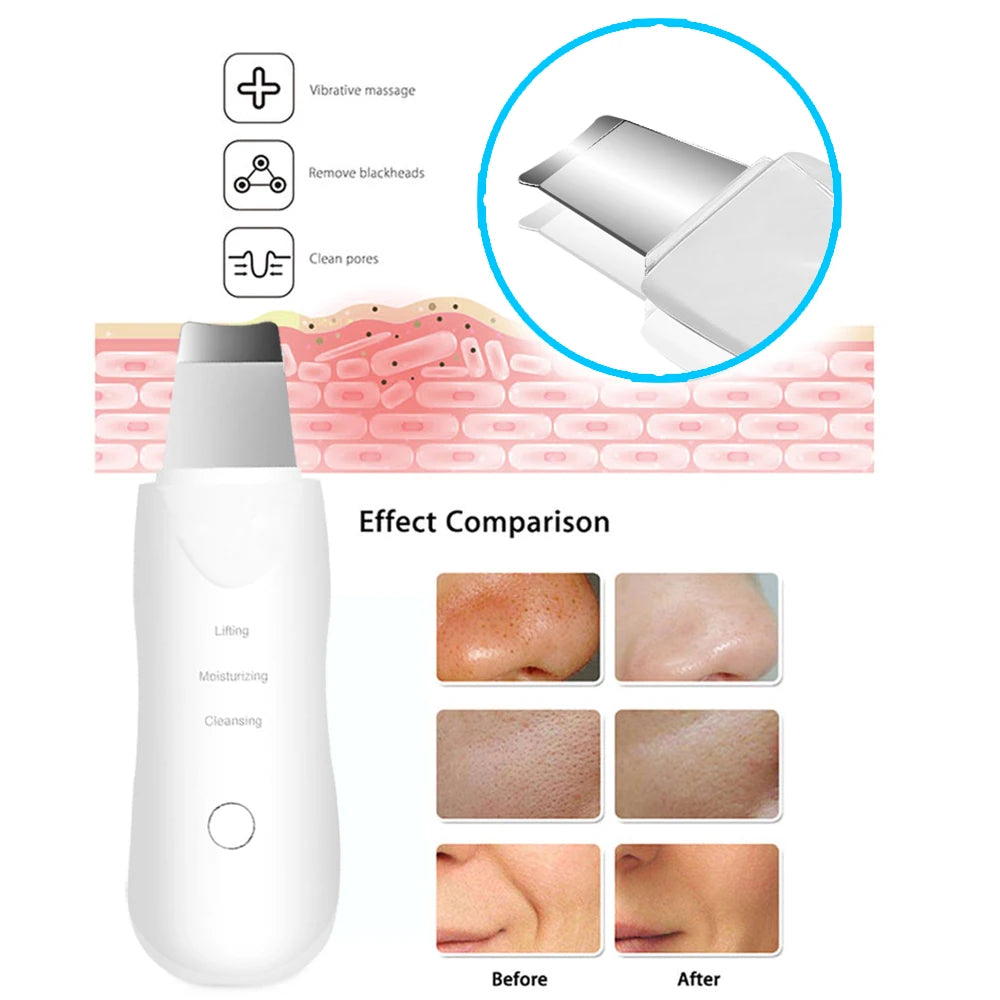 Ultrasonic Skin Scrubber & Pore Spatula⁠